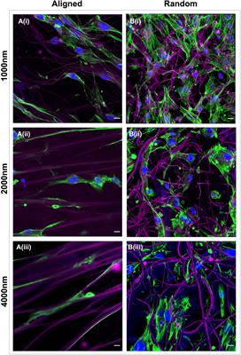 Electrospun Scaffold Micro-Architecture Induces an Activated Transcriptional Phenotype within Tendon Fibroblasts